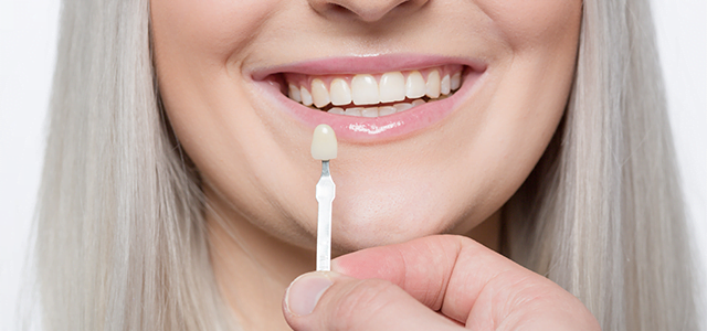 Myths and misconceptions about dental veneers