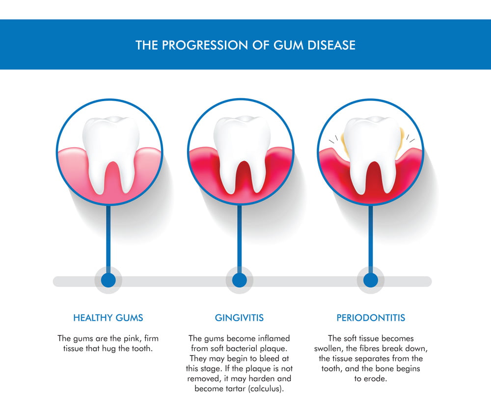 Preventative Dentistry Brisbane